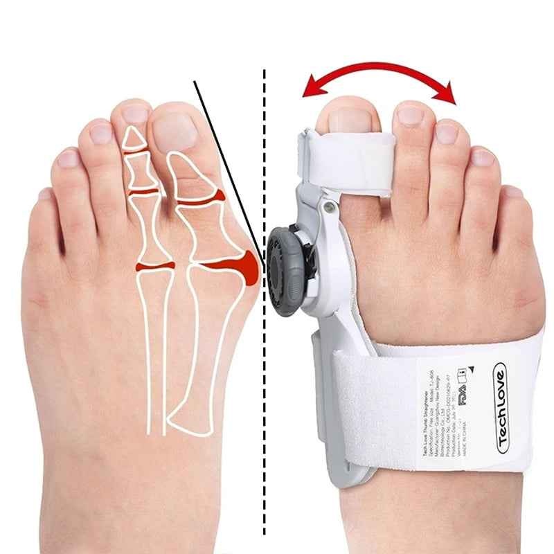 Orthèse de correction Hallux Valgus